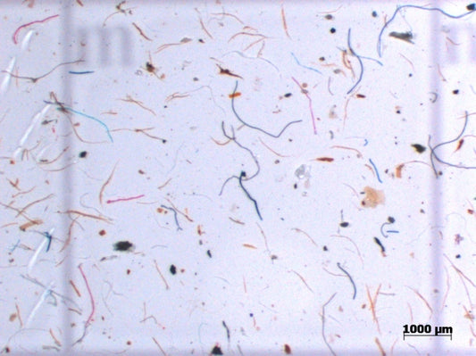 Mikroplastik einfach erklärt